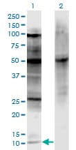 Monoclonal Mouse anti-Human p16INK4a / CDKN2A Antibody (clone 3F3, WB)