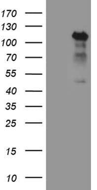 TCF12 / HEB Antibody (clone OTI3D2)