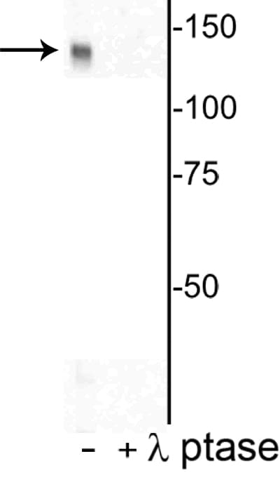 DENND3 Antibody (phospho-Thr450)