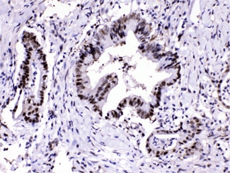 PSMA3 Antibody