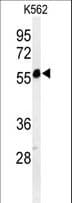 FOLH1B Antibody (aa155-183)