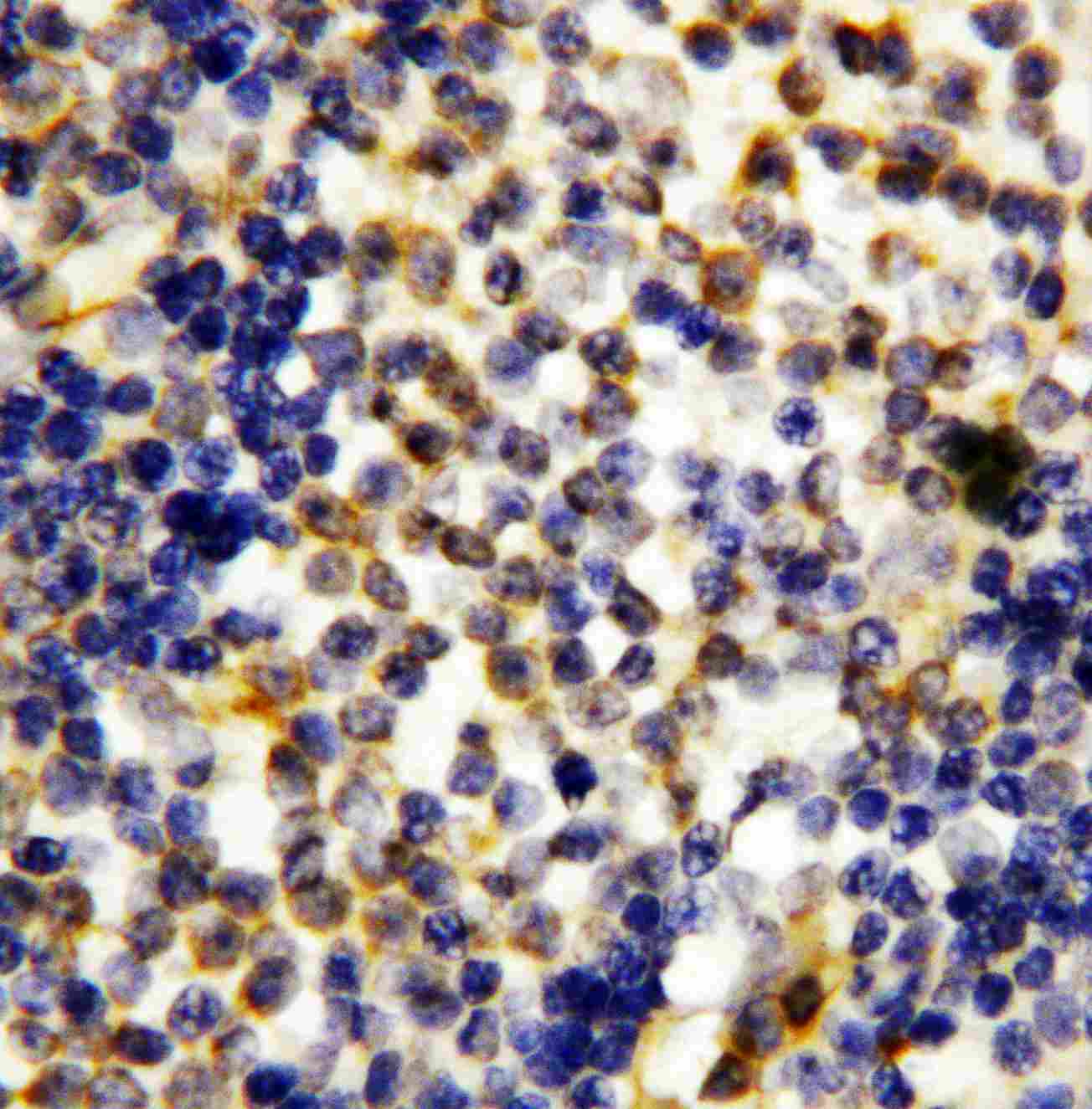 GZMA / Granzyme A Antibody (aa175-190)