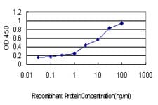 Monoclonal Mouse anti-Human STI1 / STIP1 Antibody (clone 4B6, IF, WB)