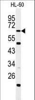 Polyclonal Rabbit anti-Human WDTC1 Antibody (aa487-516, WB)