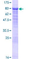 Human HDAC10 Protein (Recombinant GST)