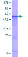 Human CECR1 Protein (Recombinant GST)
