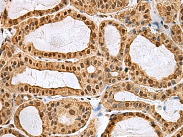 MYEF2 Antibody