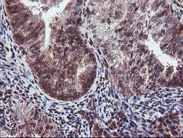 SETD7 / SET7 Antibody (clone OTI2D10)