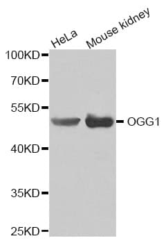 IHC-plus™ Polyclonal Rabbit anti-Human OGG1 Antibody (IHC, WB)