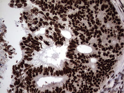 HNRNPL / hnRNP L Antibody (aa270-502, clone OTI2E4)