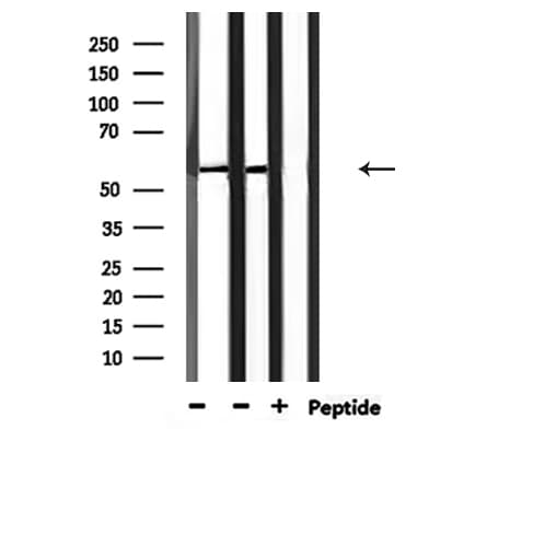 SMAD2 Antibody (phospho-Ser467)
