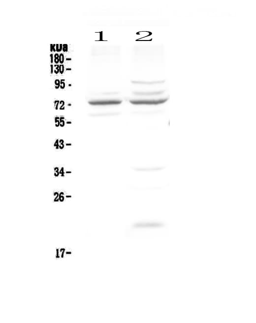 CHM / REP1 Antibody