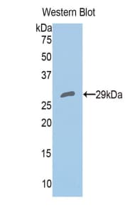 PRDX4 / Peroxiredoxin 4 Antibody (aa6-249, Cy3)