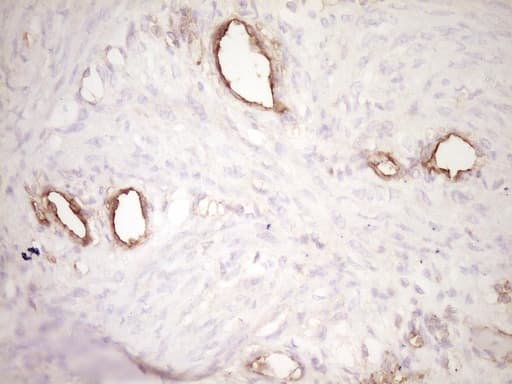 PROCR / EPCR Antibody (aa1-210, clone OTI3E7)