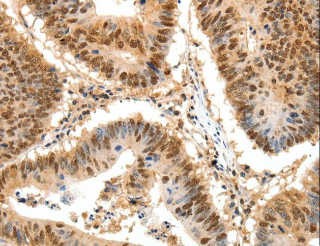 SSB / La Antibody