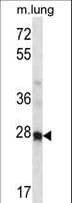 HOXA4 Antibody (aa51-79)