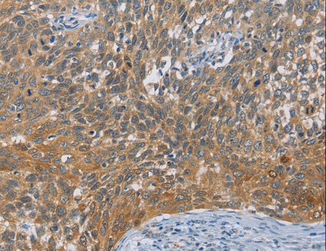 DIO1 / TXDI1 Antibody