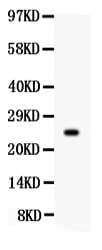PRL / Prolactin Antibody