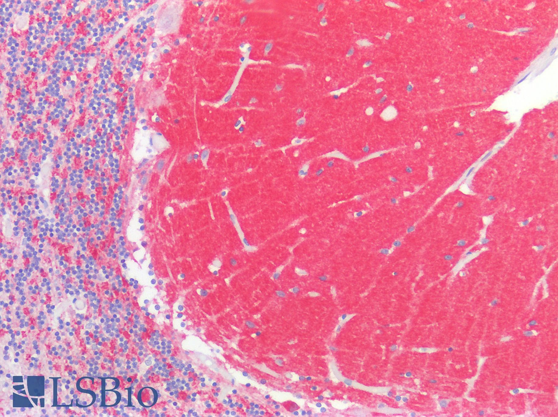 Polyclonal Rabbit anti-Human SYT1 / Synaptotagmin Antibody (aa136-422, IHC, WB)