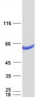 Human DPH2 Protein (Recombinant Myc-DDK (Flag))