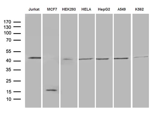 GNAS Antibody (clone OTI7D7)