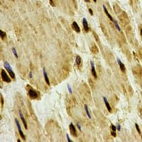 Polyclonal Rabbit anti-Human PPP1CB Antibody (IHC, IF, WB)
