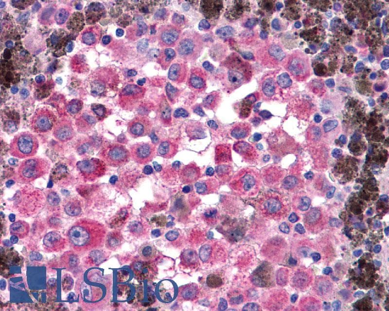 PathPlus™ Polyclonal Rabbit anti-Human GLP1R / GLP-1 Receptor Antibody (N-Terminus, IHC, IF, WB)