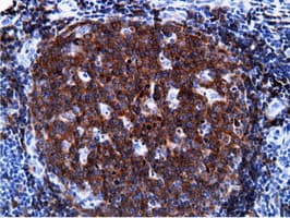 Monoclonal Mouse anti-Human BCAP / PIK3AP1 Antibody (clone OTI7A11, IHC, IF, WB)