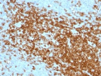 SPN / CD43 Antibody (clone SPN/1094)