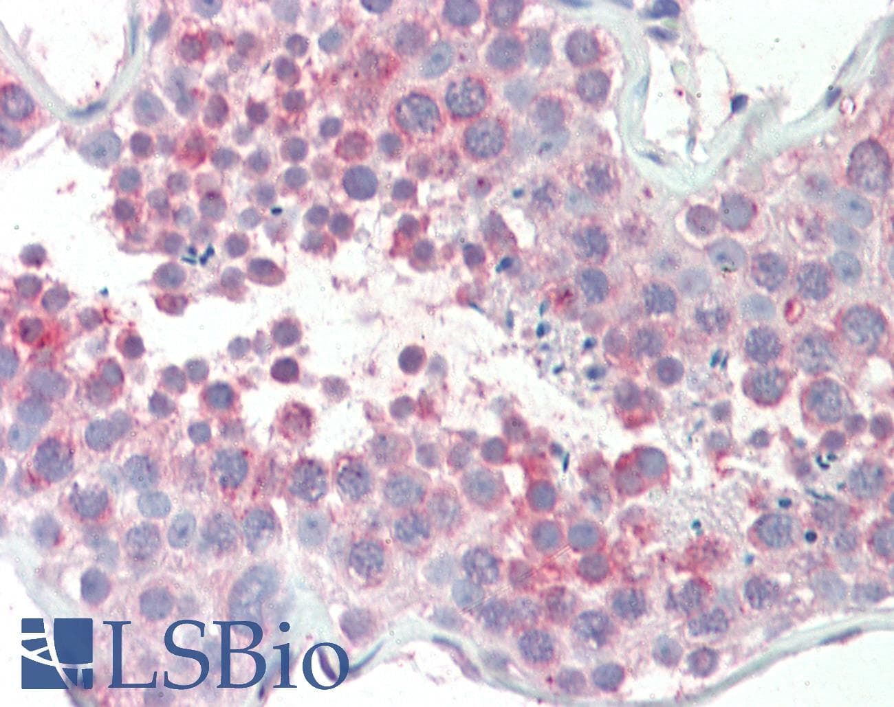 IHC-plus™ MARCH10 Antibody (aa778-788)