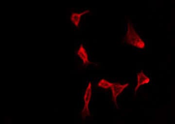 CKLFSF4 / CMTM4 Antibody