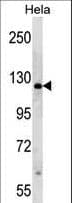 PARP1 Antibody (aa183-214)