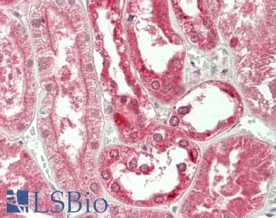 IHC-plus™ Monoclonal Mouse anti-Human MDM4 / MDMX Antibody (clone 3B9, IHC, IF, WB)