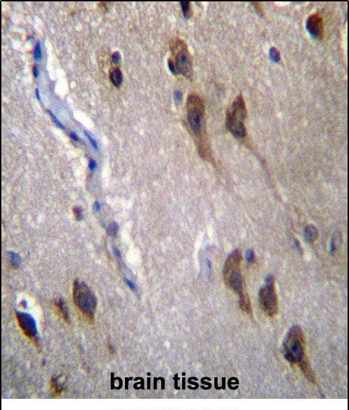 GPR45 Antibody (aa 121-149, Internal)