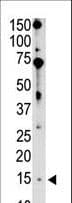 Polyclonal Rabbit anti-Human BIK Antibody (aa39-74, IHC, WB)