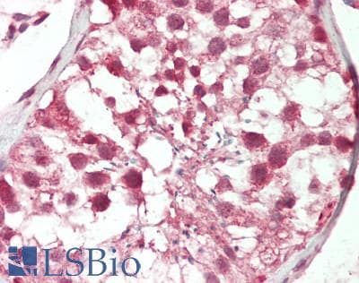 POU3F1 / OCT6 Antibody (aa361-410)