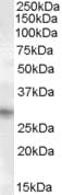 IHC-plus™ PRX-1 / PRRX1 Antibody (aa73-83)