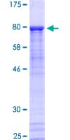 Human PKNOX2 Protein (Recombinant GST)