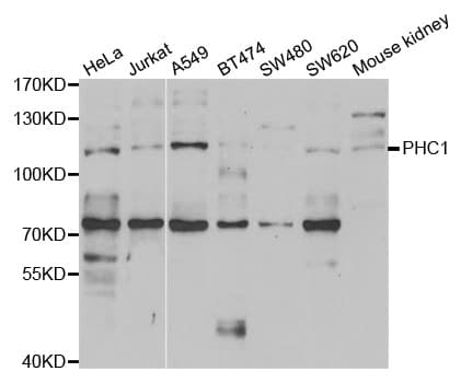Polyclonal Rabbit anti-Human PHC1 / EDR1 Antibody (IHC, WB)
