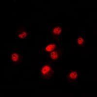 POLR3E / SIN Antibody (Internal)