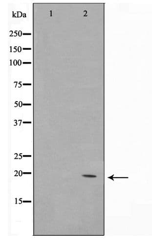 COX4I2 Antibody