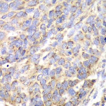 ACY1 / Aminoacylase 1 Antibody