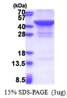 Human JMJD7 Protein (Recombinant His)
