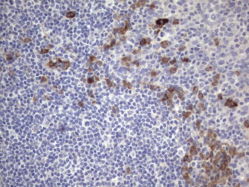 VWF / Von Willebrand Factor Antibody (aa764-1263, clone OTI2H9)