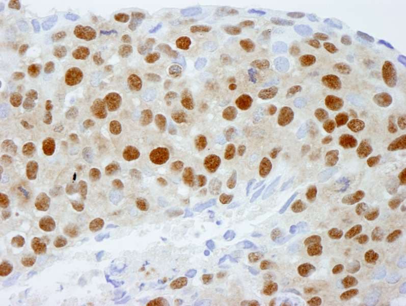 Polyclonal Rabbit anti-Human DDB1 Antibody (aa1100-C-term, IHC)