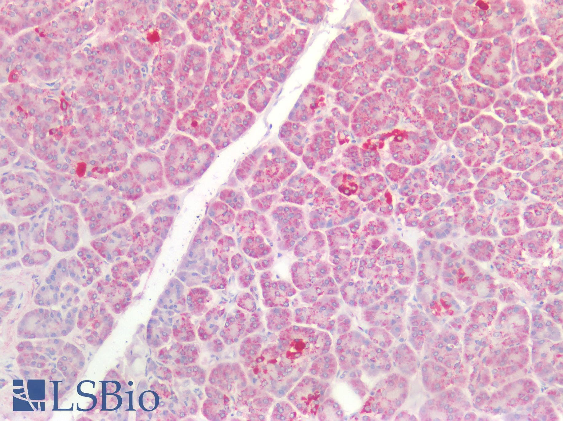PathPlus™ Polyclonal Rabbit anti-Human CLDN3 / Claudin 3 Antibody (IHC)