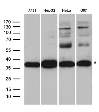 CYB5R3 / B5R Antibody
