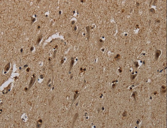Polyclonal Rabbit anti-Human PNN / Pinin Antibody (IHC)