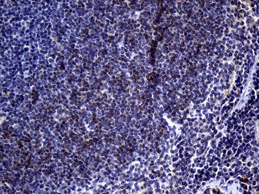 FCER2 / CD23 Antibody (aa48-321, clone UMAB101)