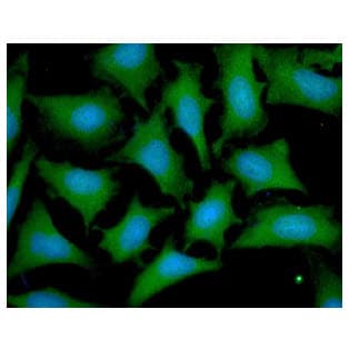 OTUB1 / OTU1 Antibody (clone AT17E10)